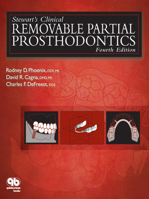 cover image of Stewart's Clinical Removable Partial Prosthodontics